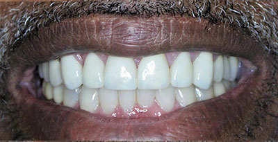 smile case transformation