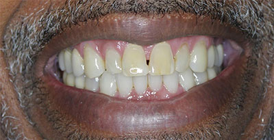 smile case transformation