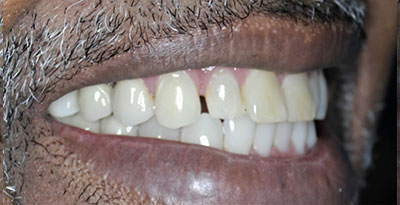 smile case transformation