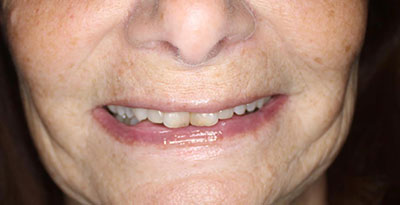smile case transformation