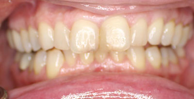 smile case transformation