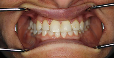 smile case transformation