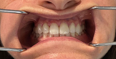 smile case transformation