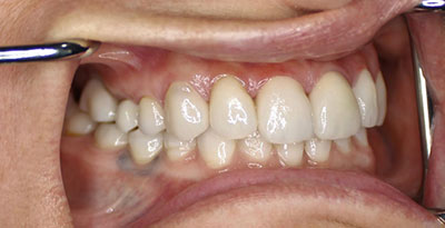 smile case transformation