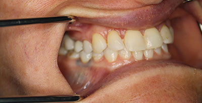 smile case transformation